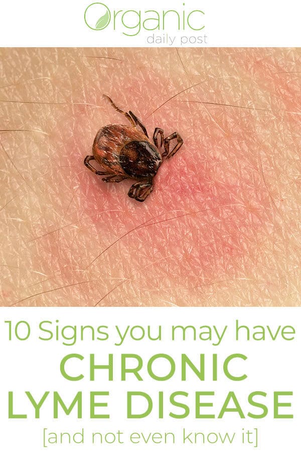 10 Signs You May Have Chronic Lyme Disease…And Not Even Know It
